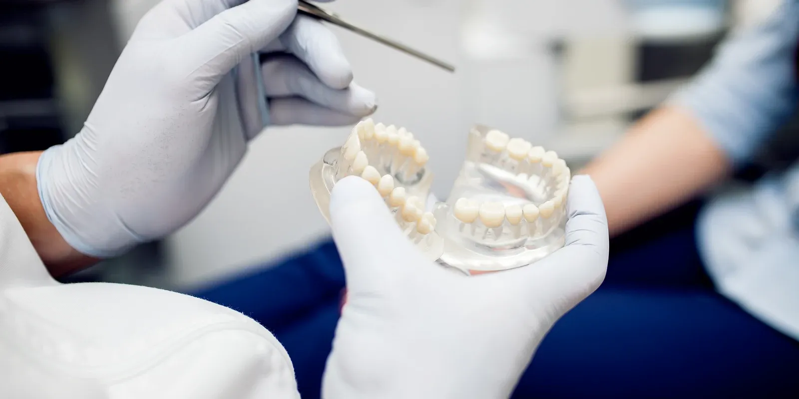Dental Bridges vs. Other Tooth Replacement Options: What’s Best for You?