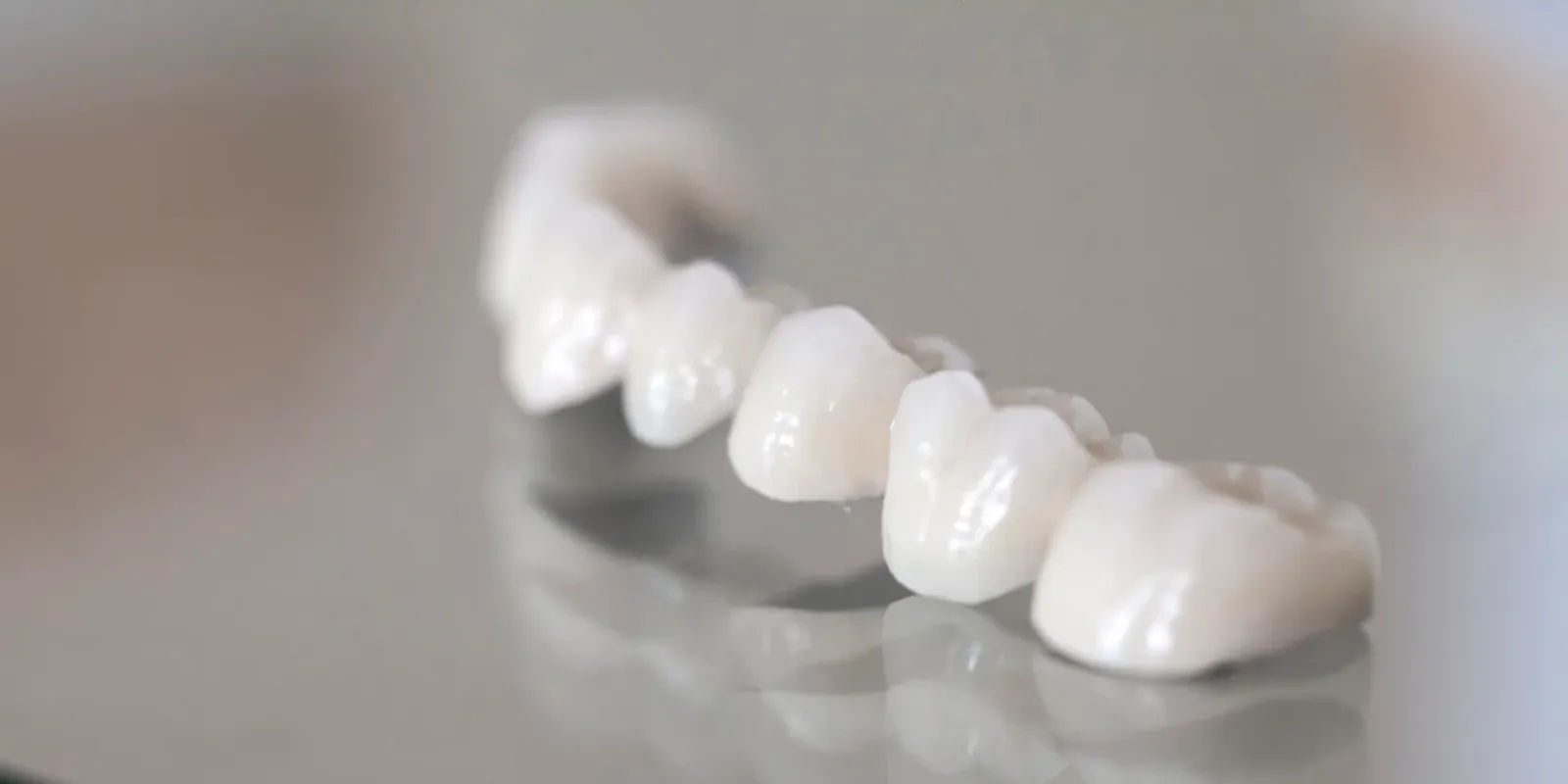 Dental Crowns and Dental Bridges