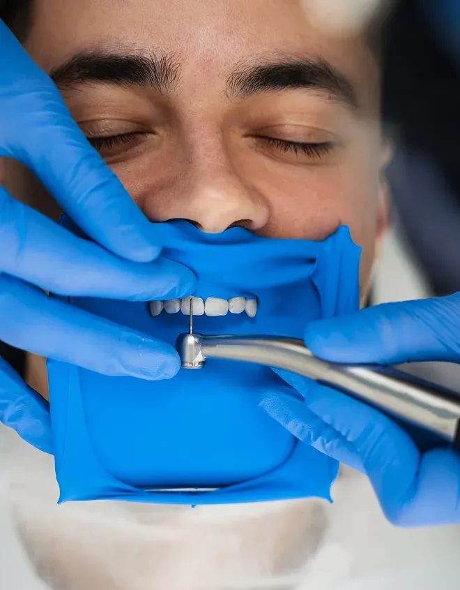 Eating with Dental Bridges: What to Expect and How to Adjust?