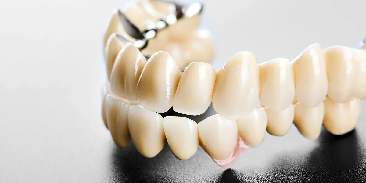 Long-Term Benefits of Dental Bridges: A Smart Investment for Your Teeth
